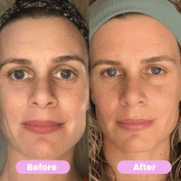 7-in-1 LED Face Firming & Massage Tool – Vénera-White-State of Style