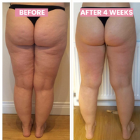 Anti-cellulite Cupping Device - SlimCupp-Green-State of Style