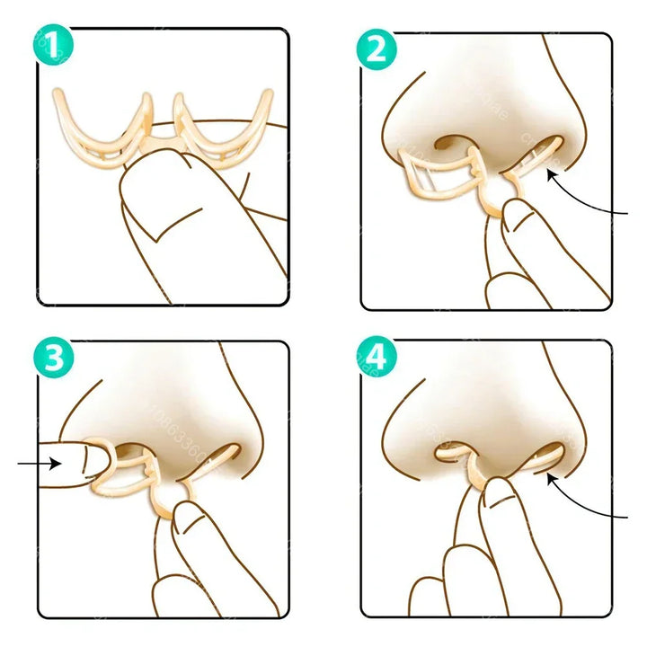 Comfortable Anti-Snoring Device - AirEase-1 piece-State of Style