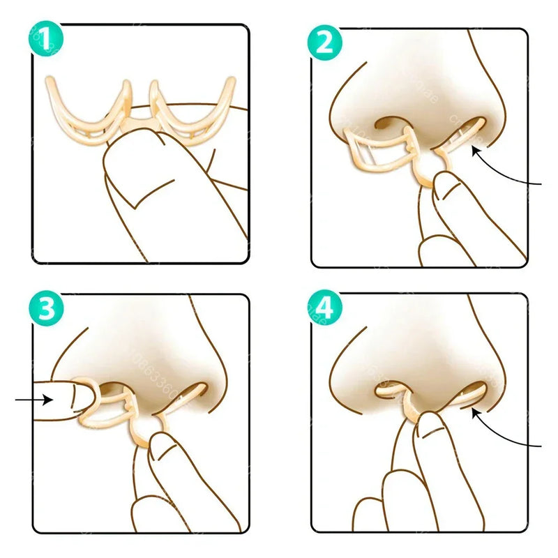 Comfortable Anti-Snoring Device - AirEase-1 piece-State of Style