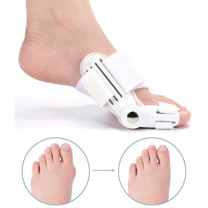 Corrective Splint for Hallux Valgus (1 Pair) - BunionFix-White-State of Style