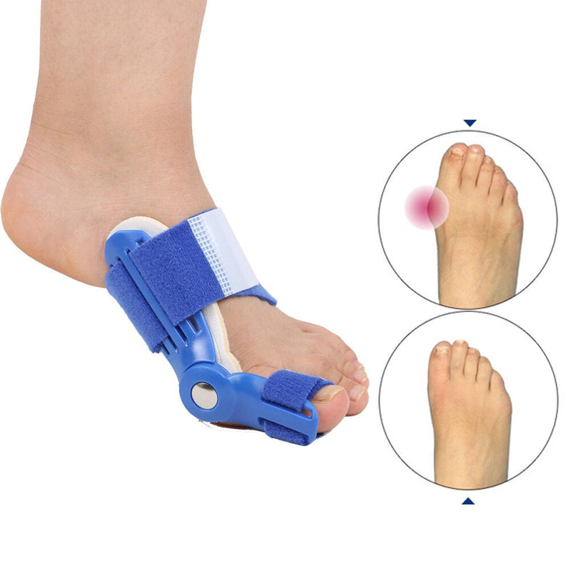 Corrective Splint for Hallux Valgus (1 Pair) - BunionFix-White-State of Style