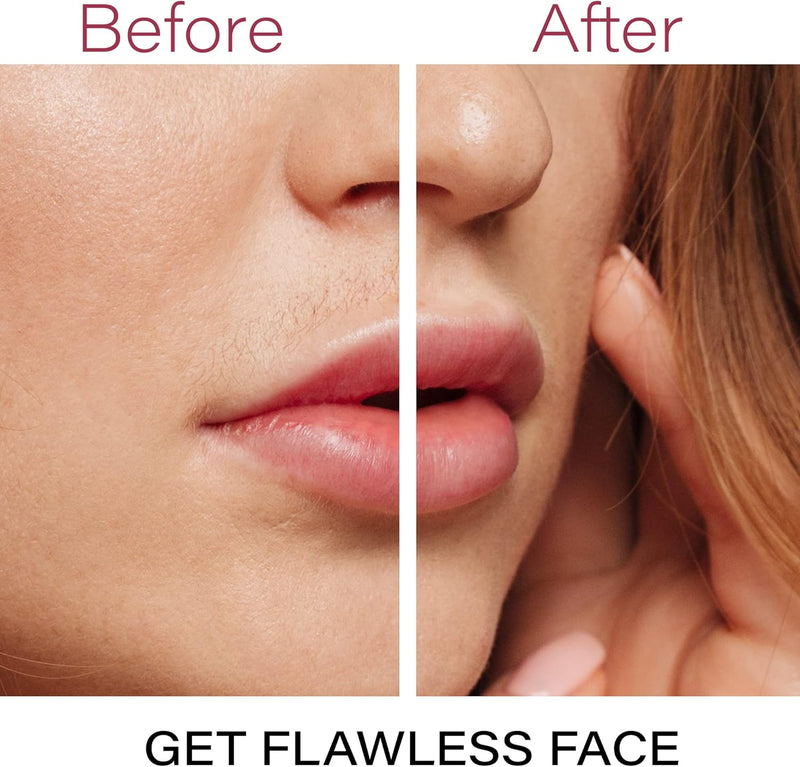 Flawless Facial Hair Remover – Discover Smooth Skin Now!-Rose gold-State of Style