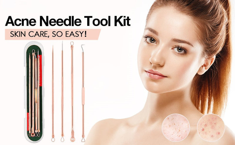 Mee-eter & Park Removal Kit-State of Style