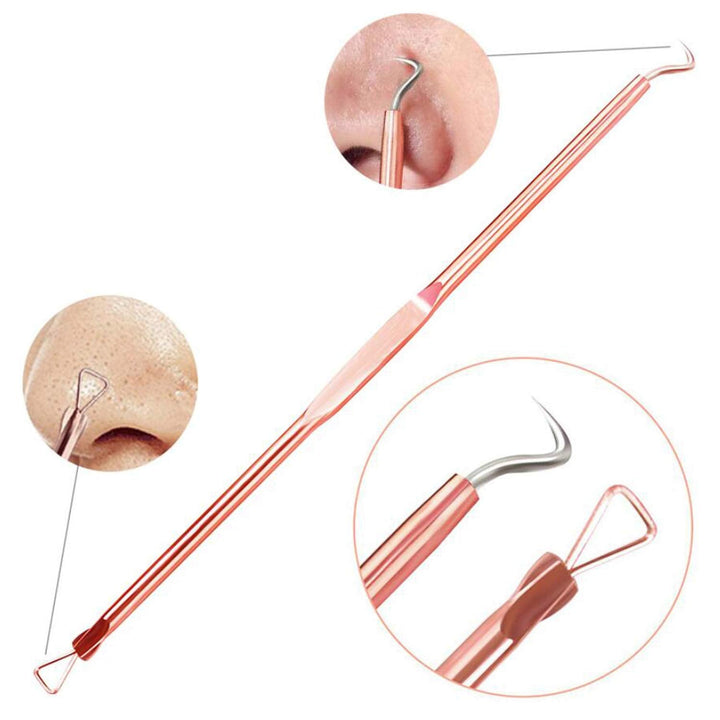 Mee-eter & Park Removal Kit-State of Style