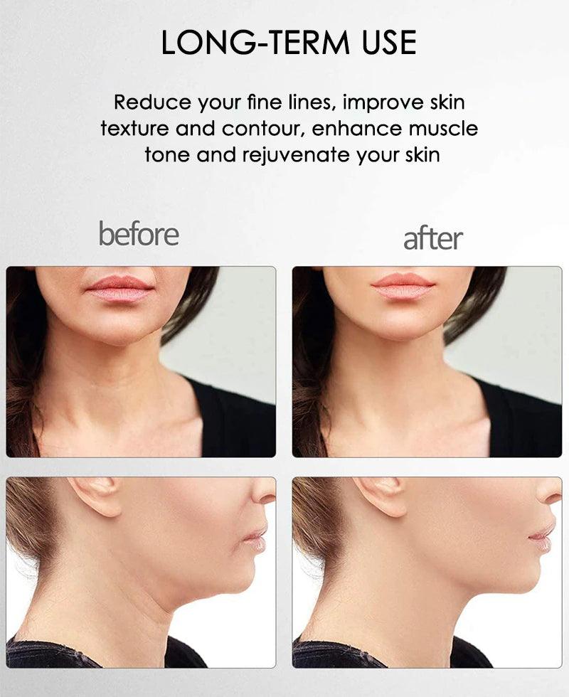 Microcurrent Facial Massager - FirmGlow-State of Style