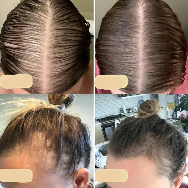 Natural Hair Growth Oil - PureGrowth-1 Piece-State of Style