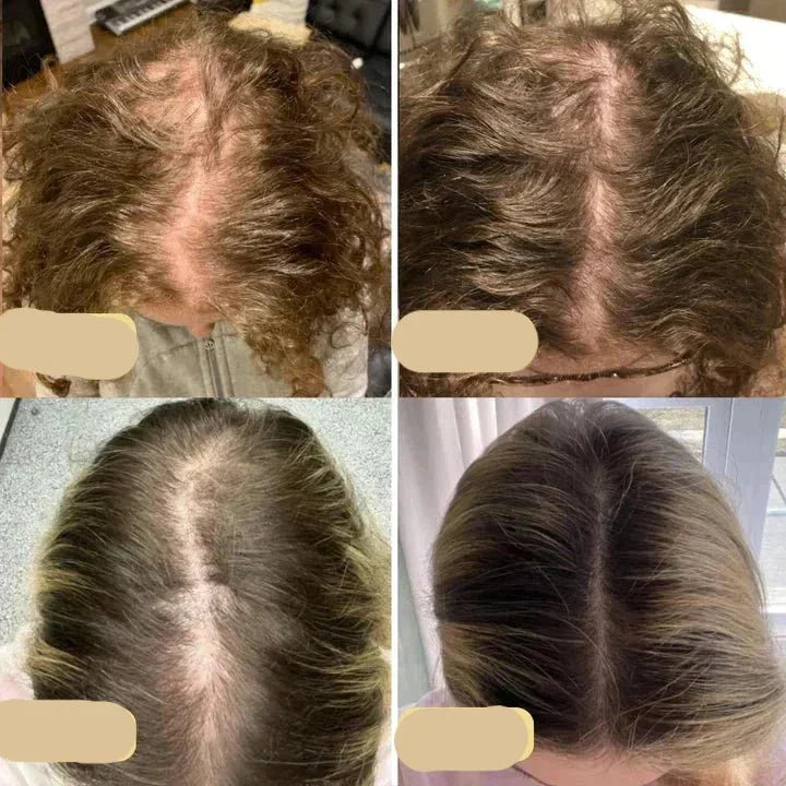 Natural Hair Growth Oil - PureGrowth-1 Piece-State of Style