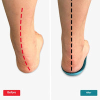 Orthopaedic Insoles – StepRelief-4.5-5.5-State of Style