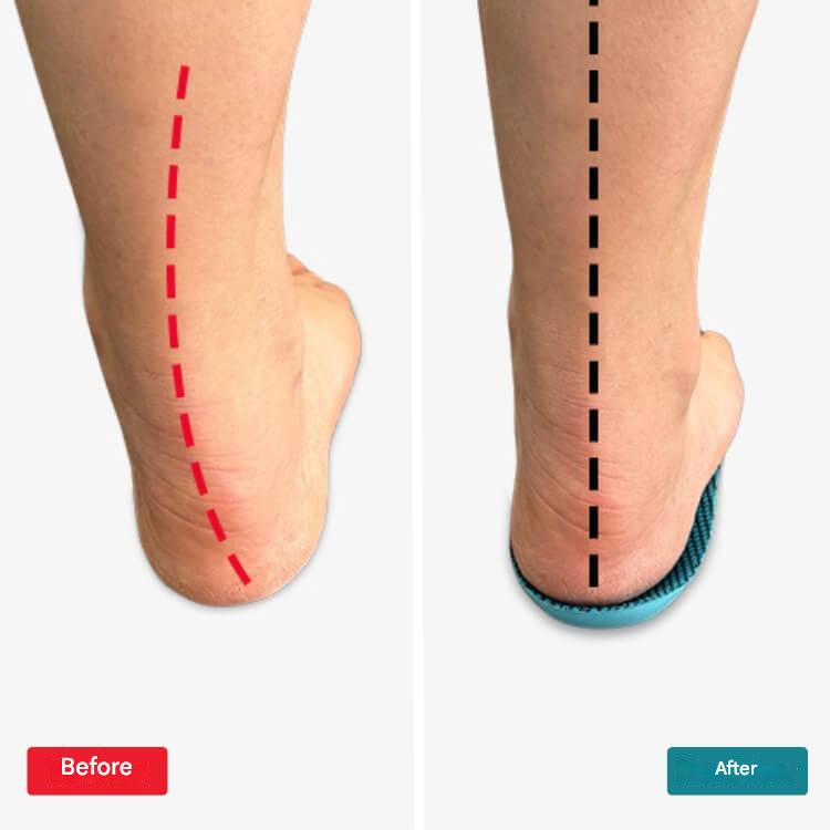 Orthopaedic Insoles – StepRelief-4.5-5.5-State of Style