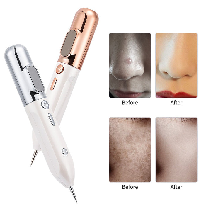 Plasma Skin Rejuvenation Pen - GlowLift-Gold-State of Style