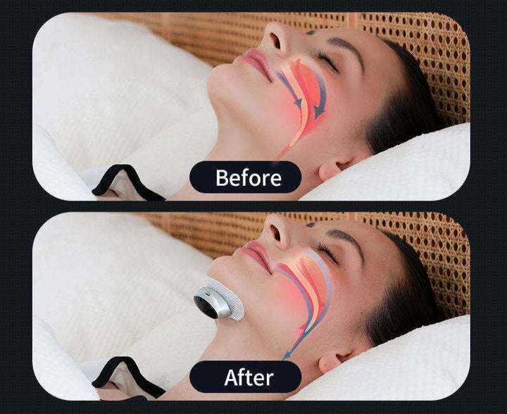 Sleep Apnoea Aid - AirEase-State of Style