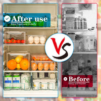 Stackable Fridge Organizer Set of 10 - FridgeMaster-State of Style