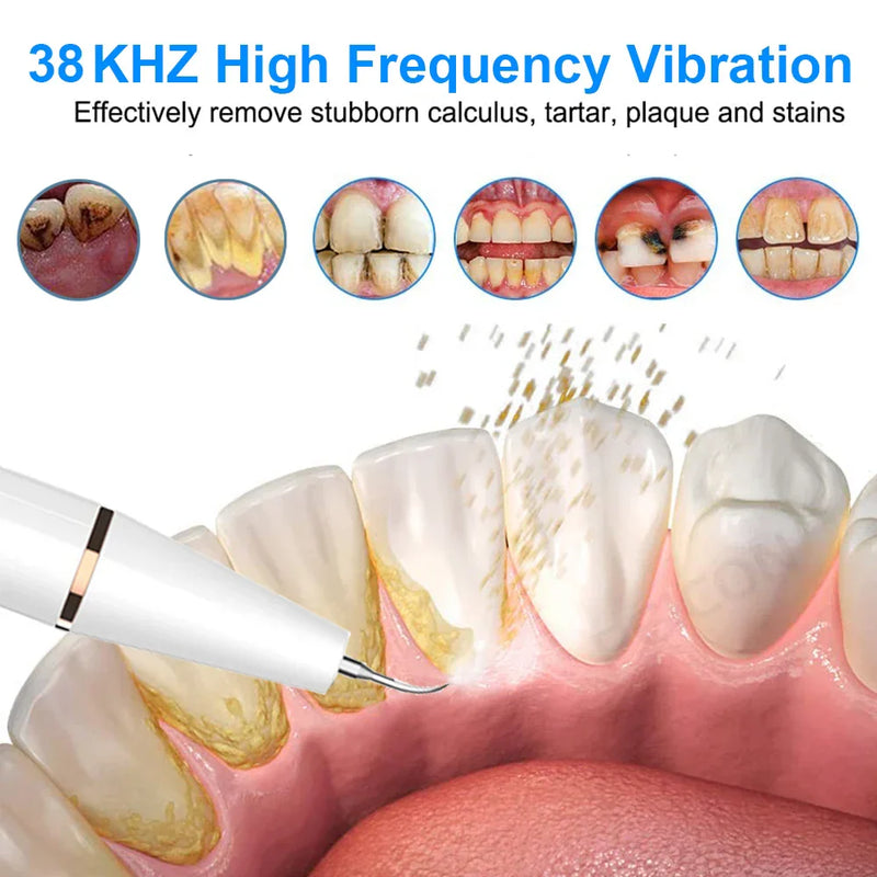 Ultrasonic Tooth Cleaner - SonicClean-White-State of Style