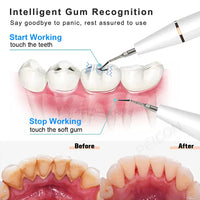 Ultrasonic Tooth Cleaner - SonicClean-White-State of Style